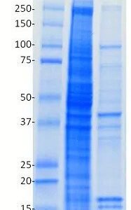 10x RIPA Buffer